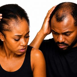Hair loss